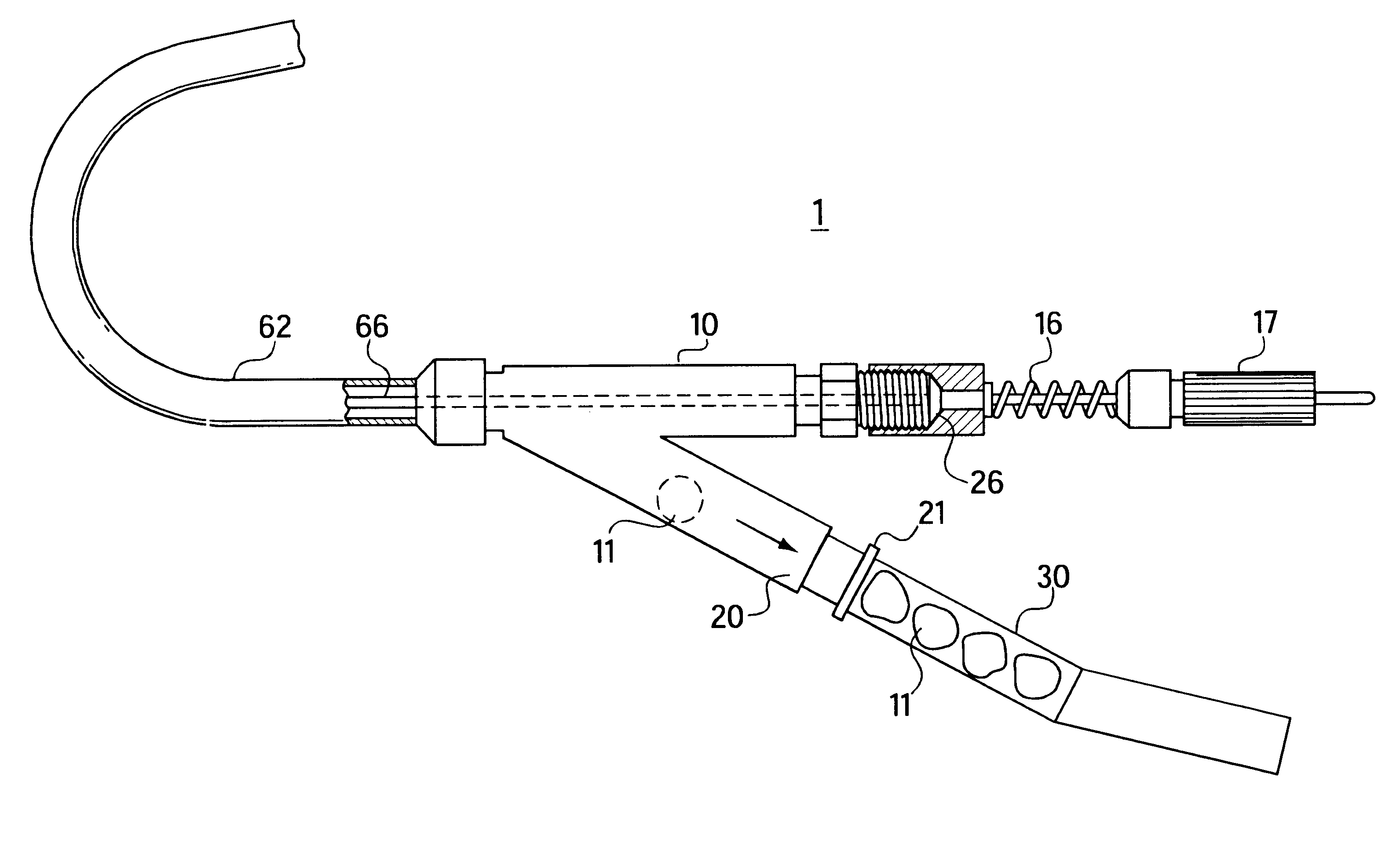 Apparatus for separable external serial collection, storage and processing of biopsy specimens