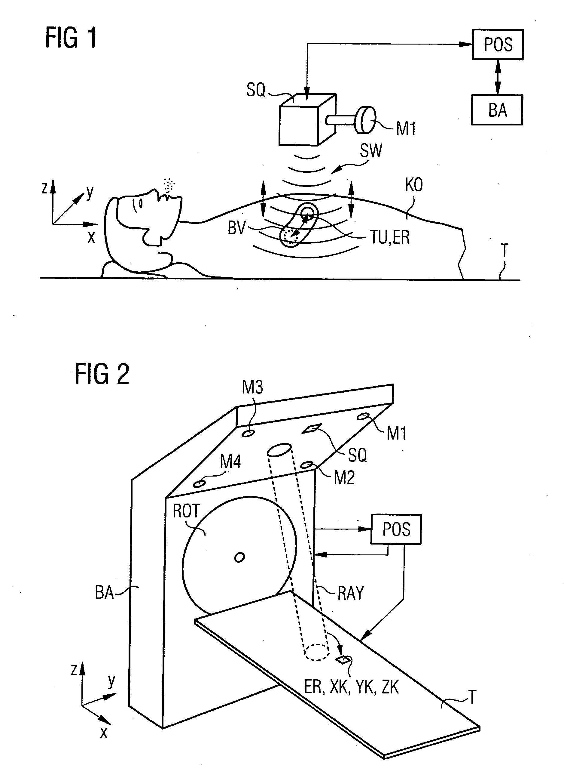 Device for spatial localization of a movable part of the body