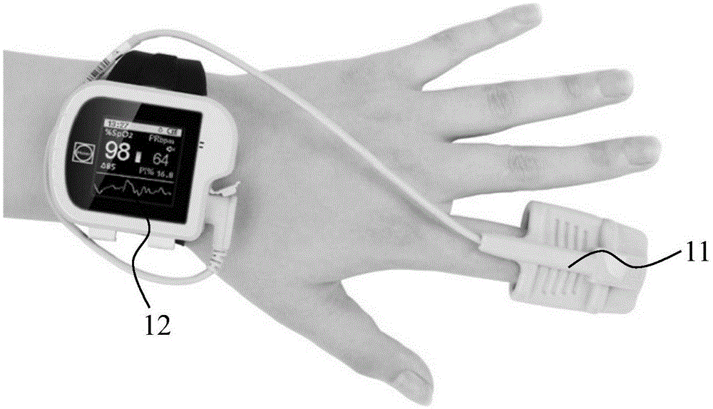 Intelligent watch and blood pressure detection method