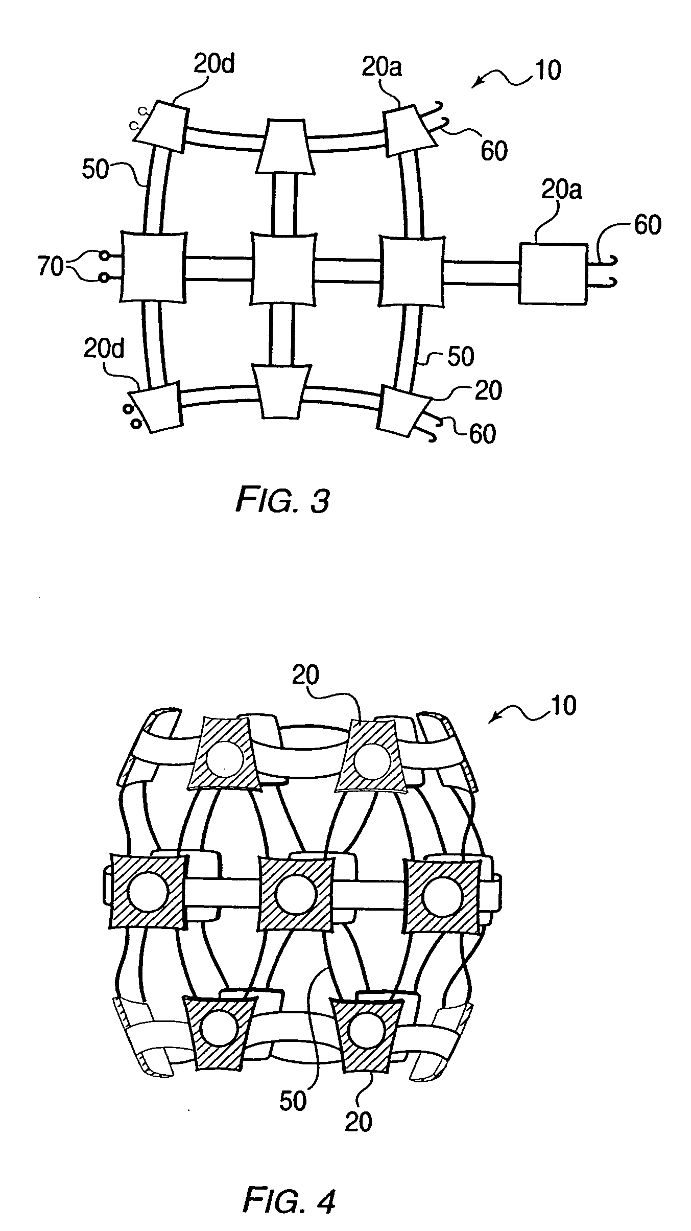 Delivery device for stimulating the sympathetic nerve chain