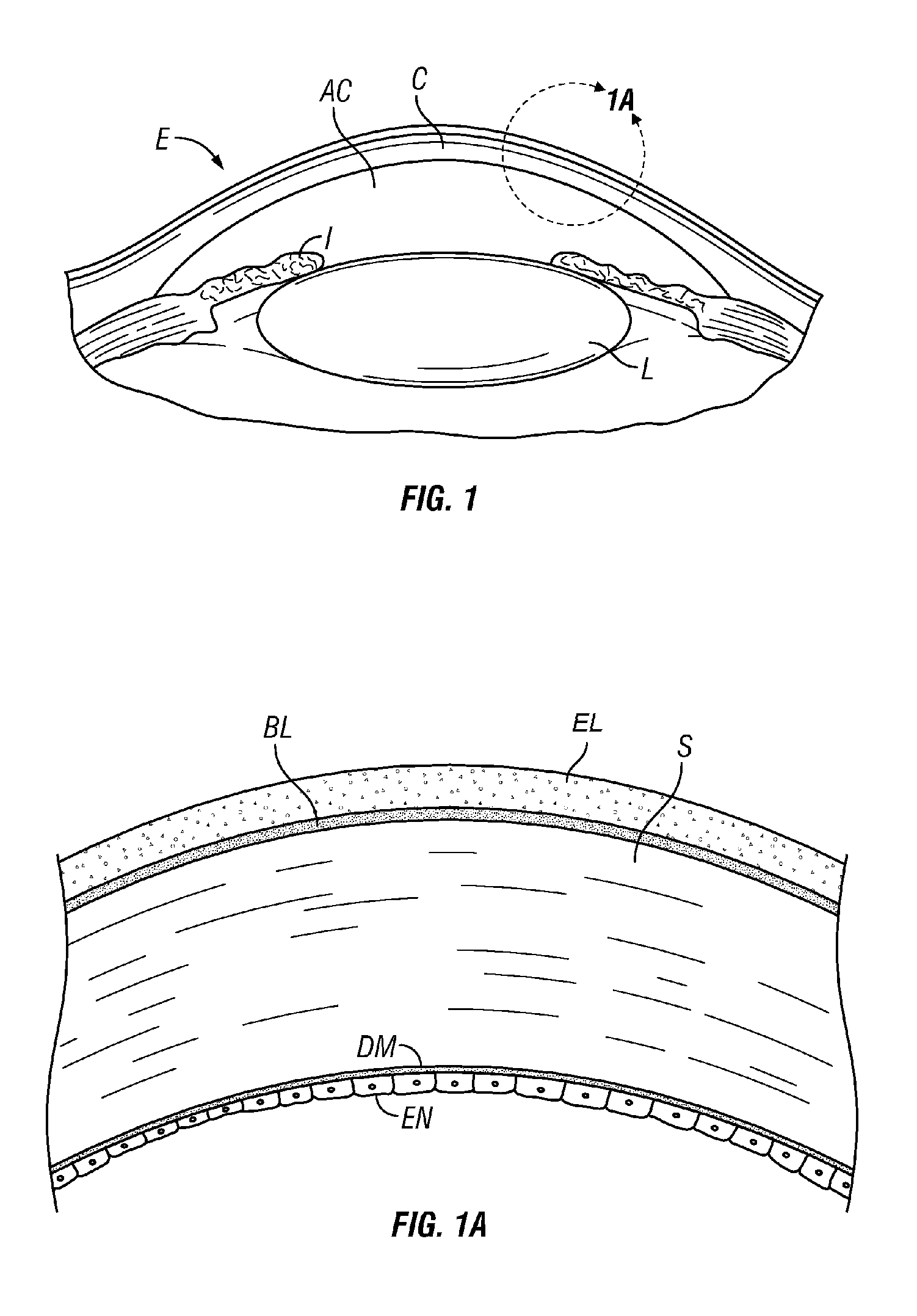 Methods and devices for crosslinking of corneal collagen and for treatment of disorders of the eye