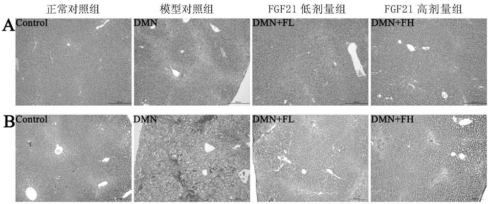 Application of fibroblast growth factor-21 mature peptide in preparation of hepatic fibrosis treatment drugs