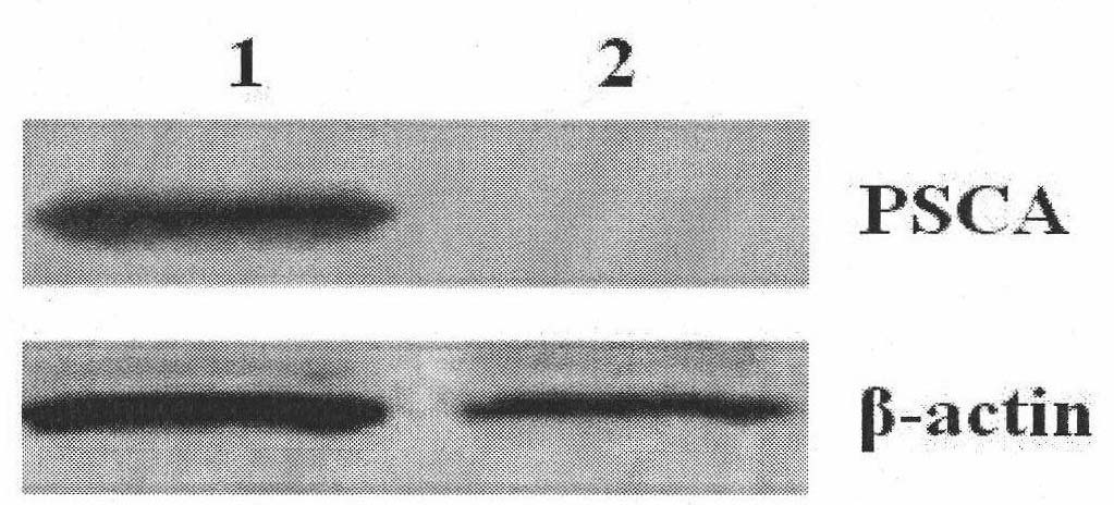 Compound of prostate stem cell antigen and heat shock protein and preparation method and application thereof