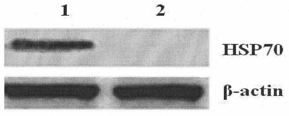 Compound of prostate stem cell antigen and heat shock protein and preparation method and application thereof