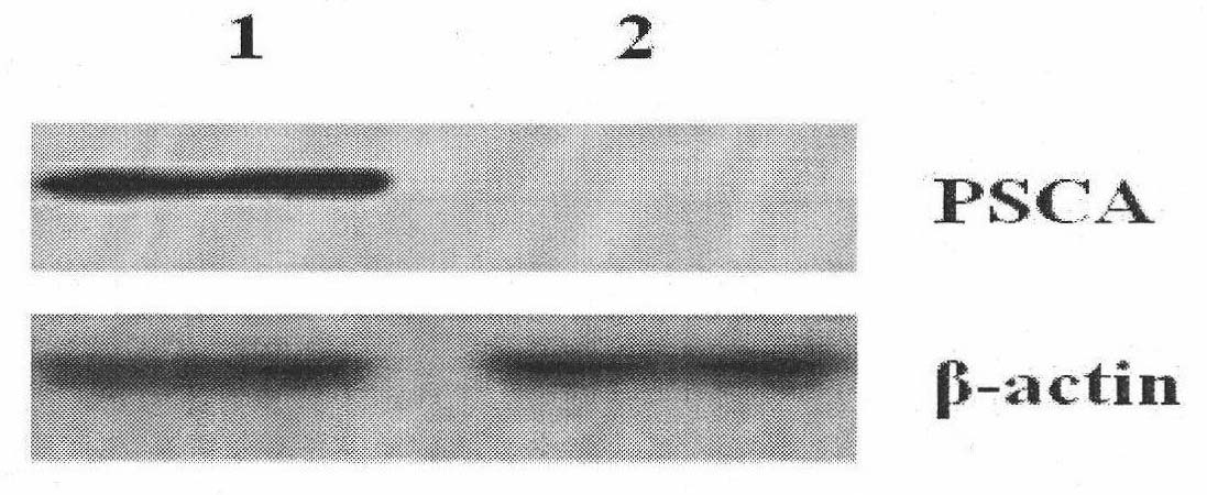 Compound of prostate stem cell antigen and heat shock protein and preparation method and application thereof