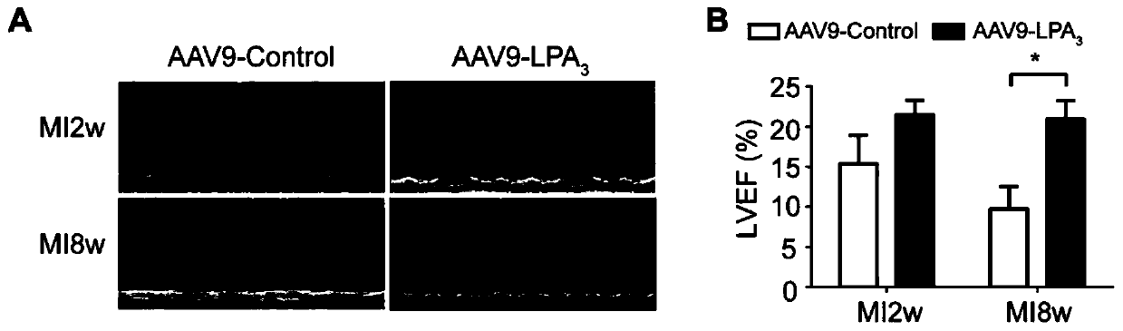 Use of lysophosphatidic acid, lysophosphatidic acid receptor 3, and lysophosphatidic acid receptor 3 agonists