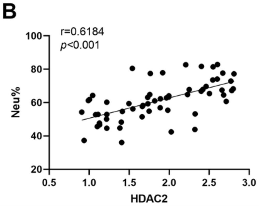 Use of HDAC2 in preparation of marker for evaluating progress of hepatic inflammation of acute hepatic failure