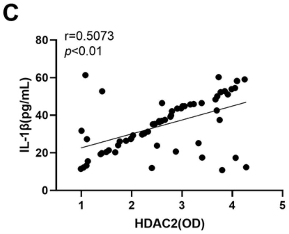 Use of HDAC2 in preparation of marker for evaluating progress of hepatic inflammation of acute hepatic failure