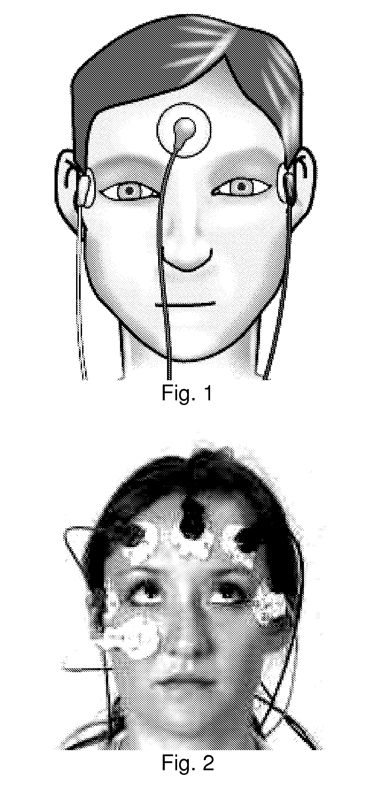 Wearable head-mounted, glass-style computing devices with eog acquisition and analysis for human-computer interfaces