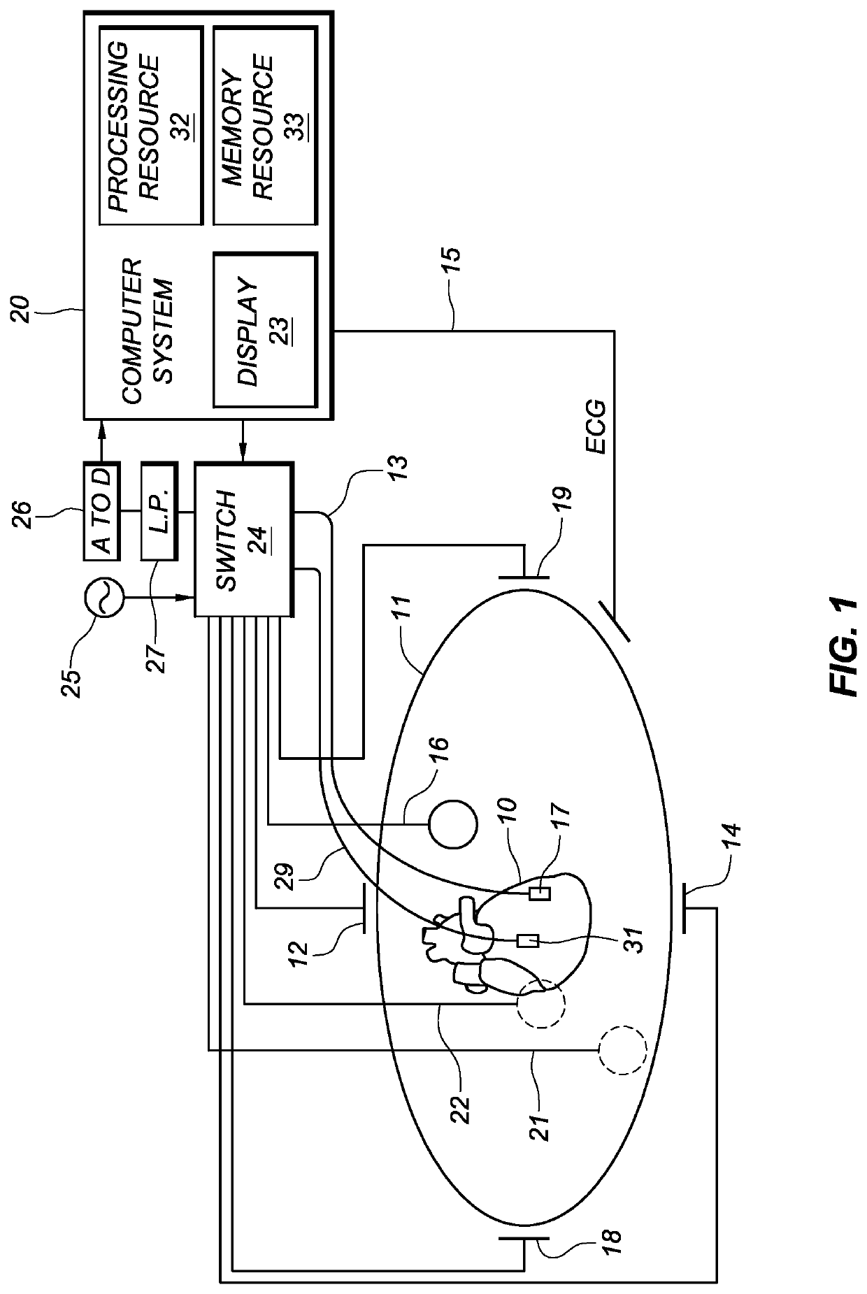 Reliability determination of electrode location data