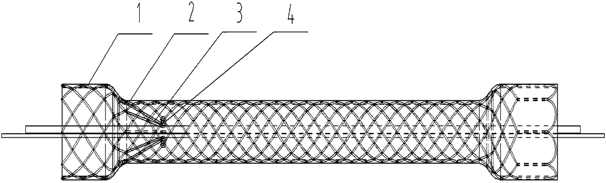 Anti-reflux esophageal stent