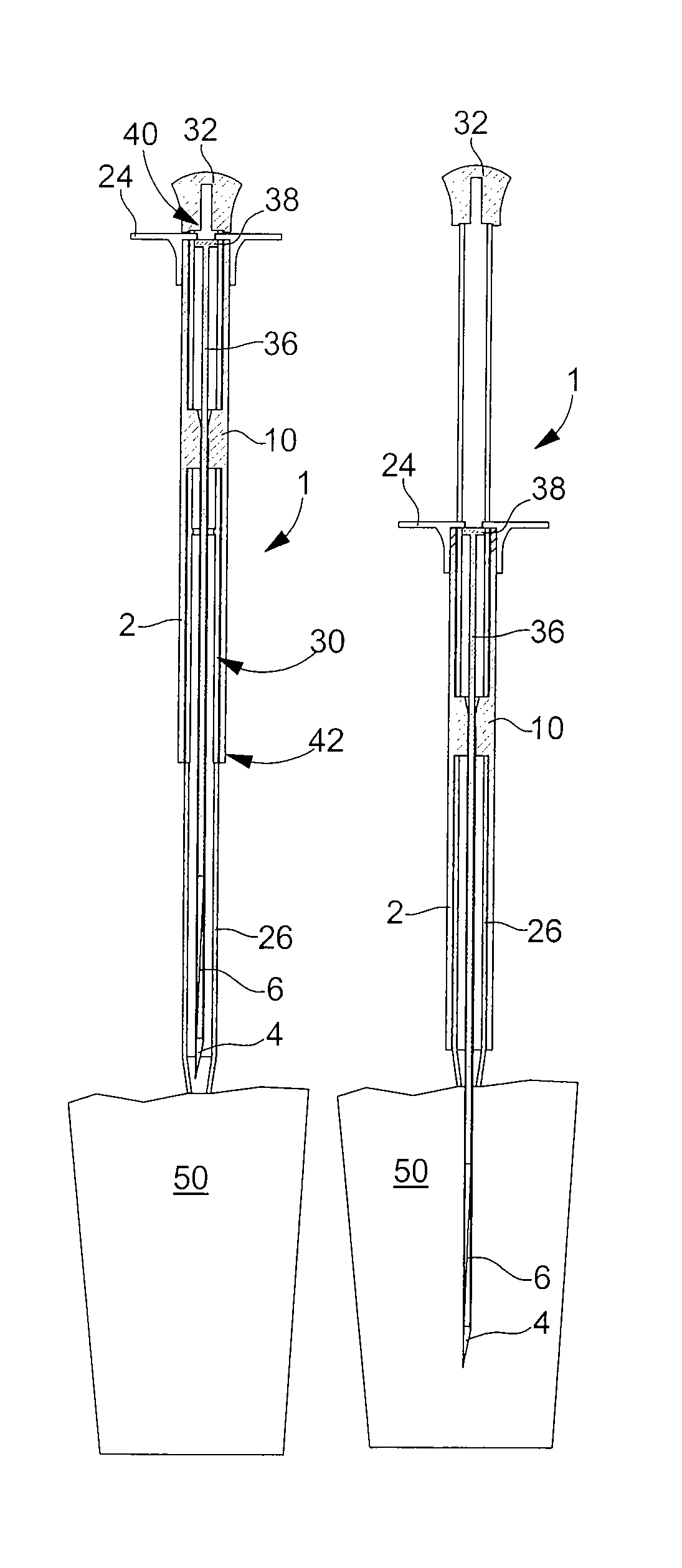 Device for the injection of a solid or semi-solid implant