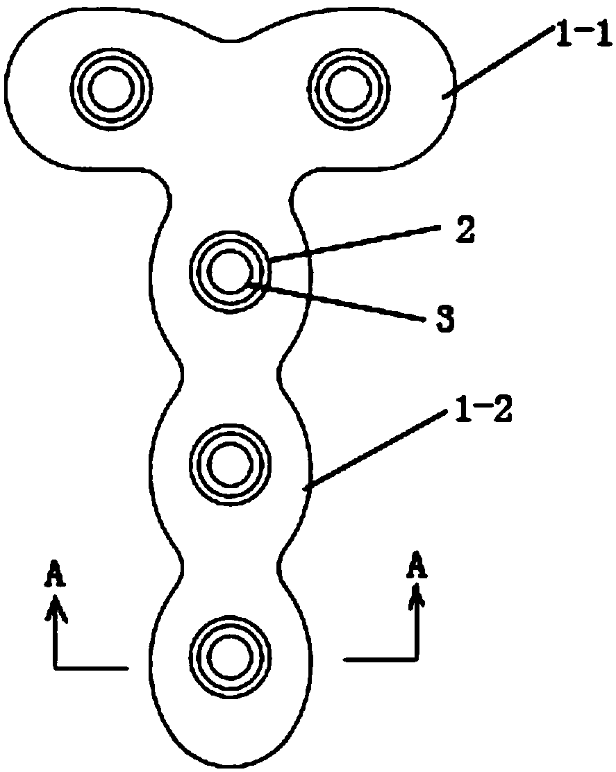 T-shaped bone plate