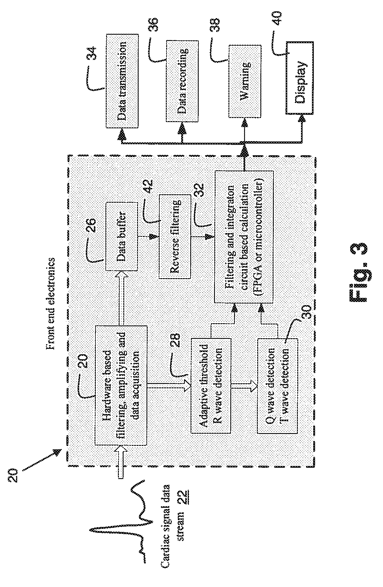 System for Cardiac Medical Condition Detection and Characterization