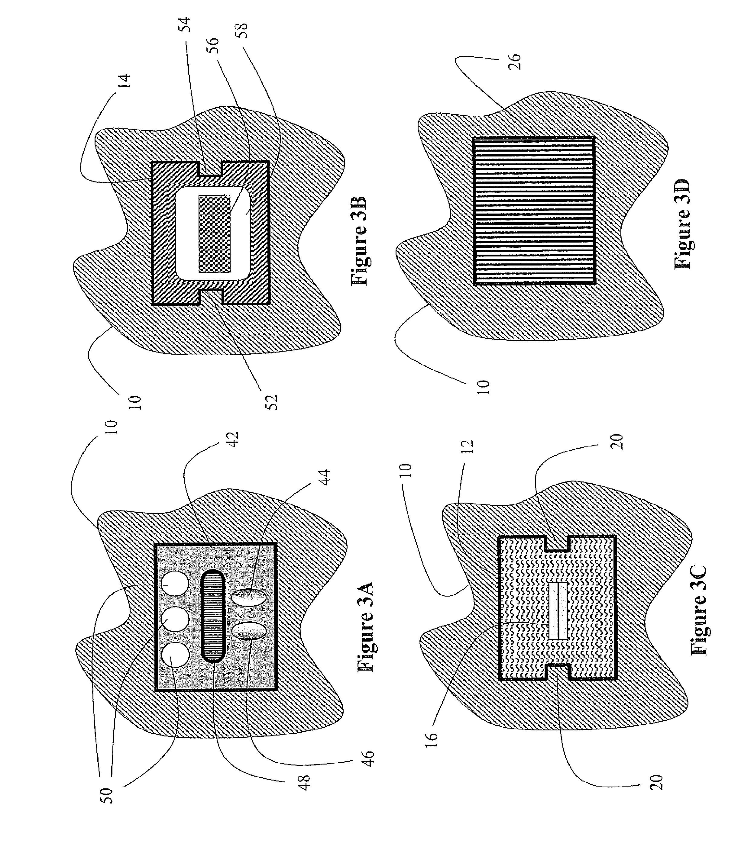 Internal ufd