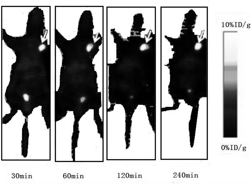 18F marked affinity compound and preparation method and application thereof