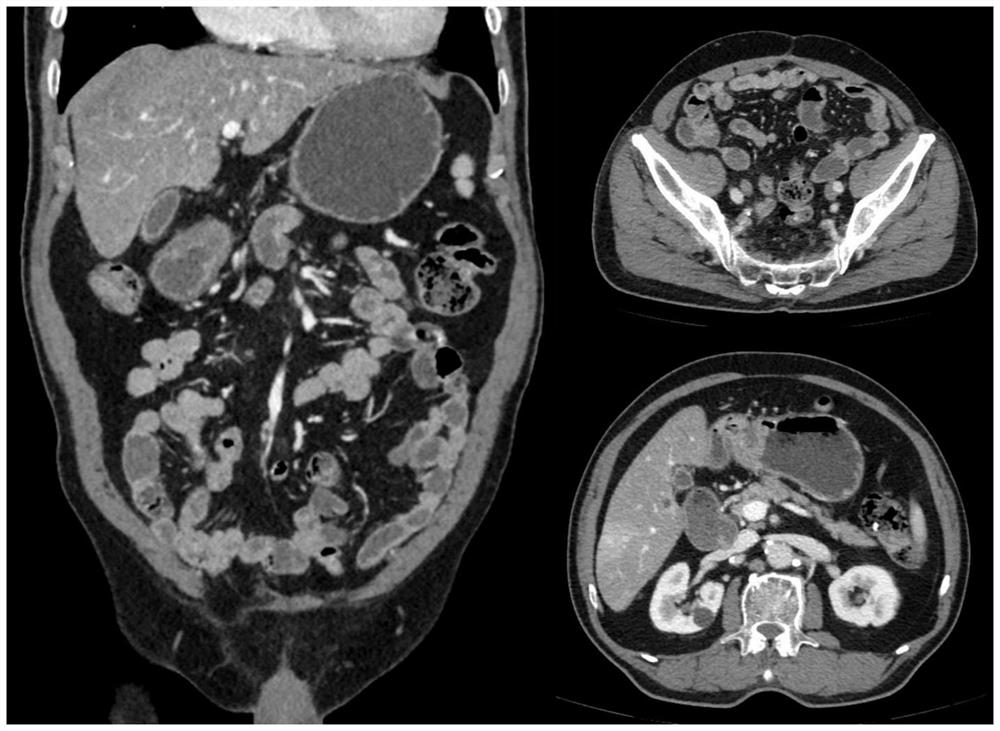 Traditional Chinese medicine composition for abdominal enhancement as well as preparation method and application of traditional Chinese medicine composition