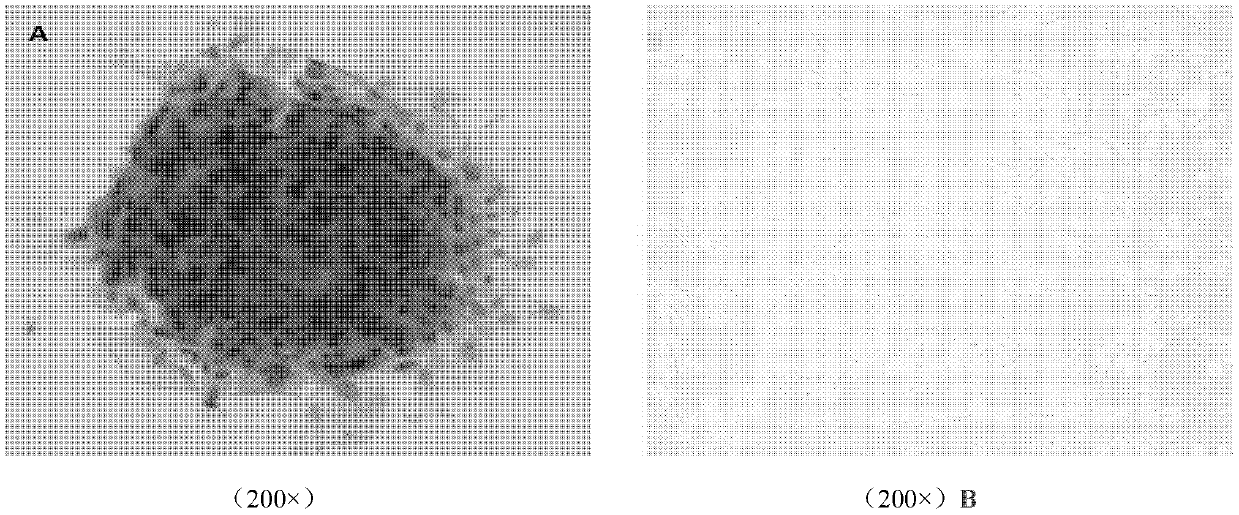 Establishment and application of mmhrl1 transgenic mouse liver tumor cell line