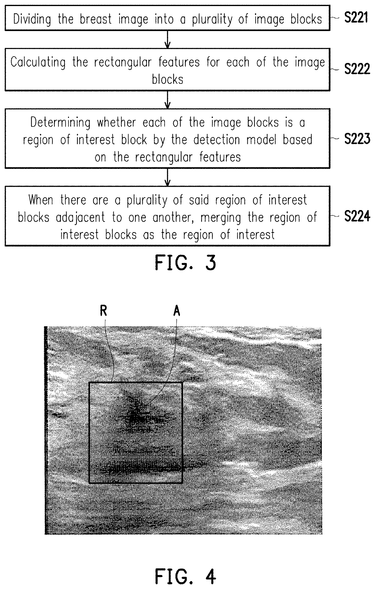 Analysis method for breast image and electronic apparatus using the same