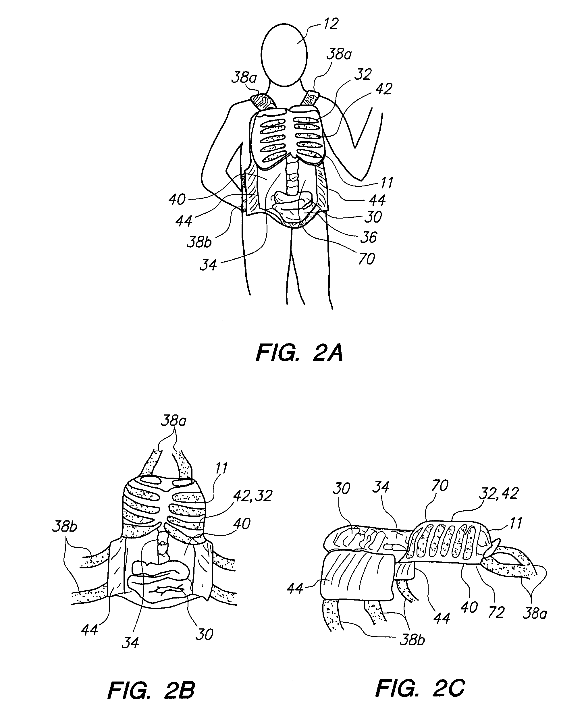 Wearable partial task surgical simulator