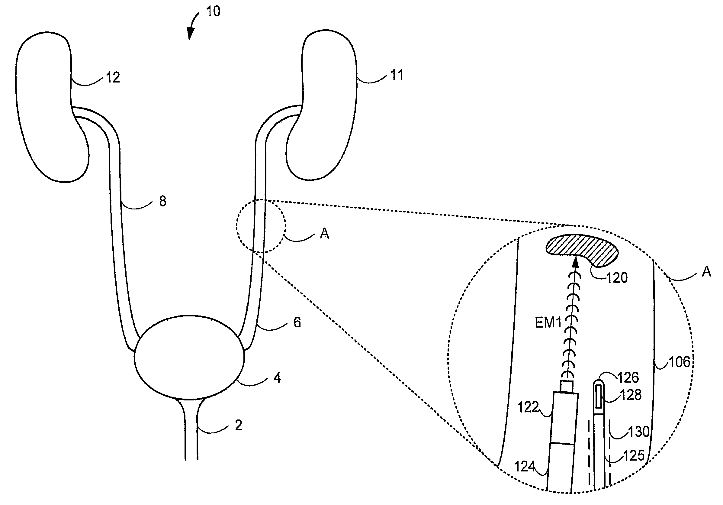 System and method for imaging during a medical procedure