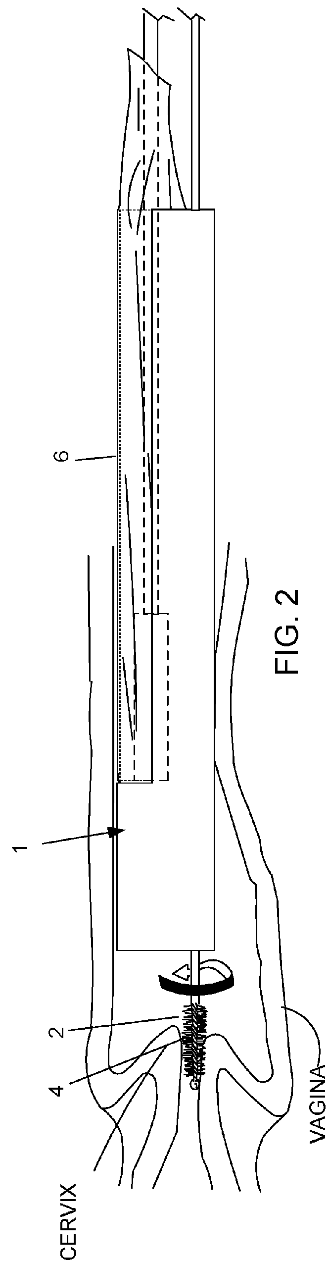 Device and method for conducting a pap smear test