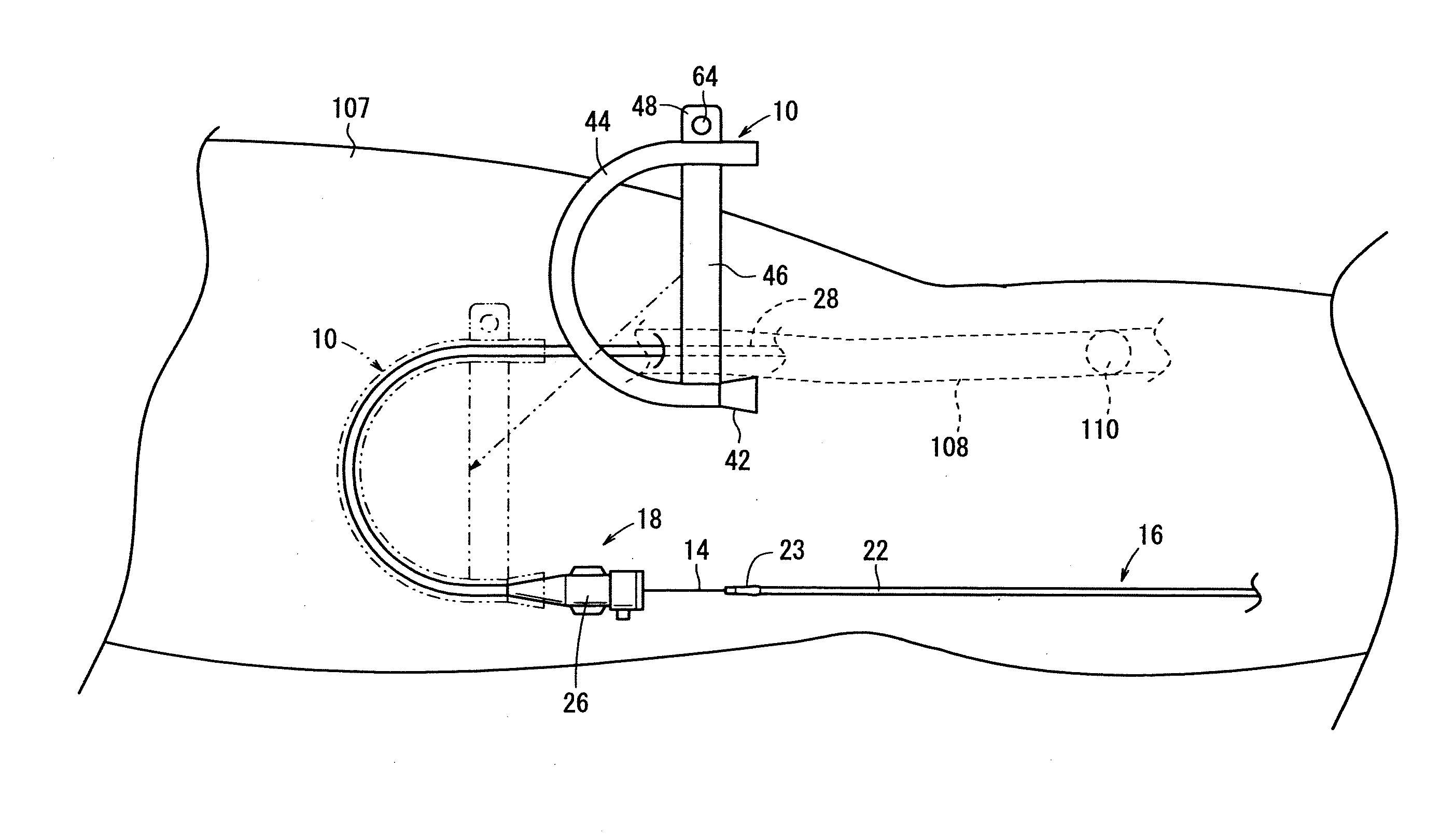 Direction changing device, medical assembly having the same, and method