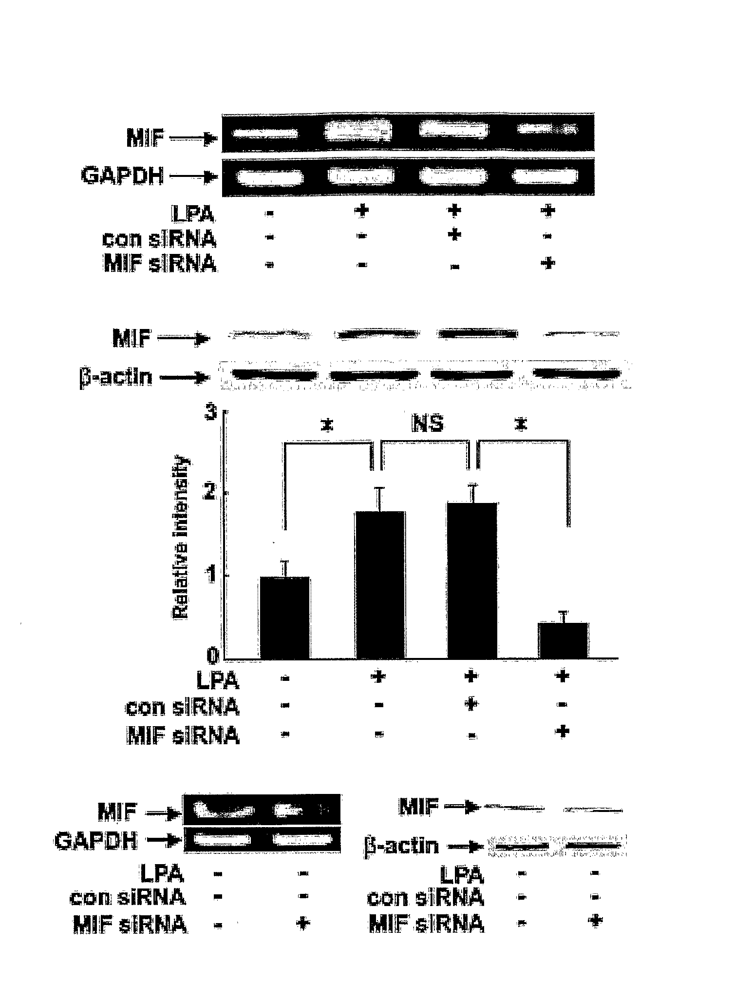 Pharmaceutical Agents for Preventing Metastasis of Cancer