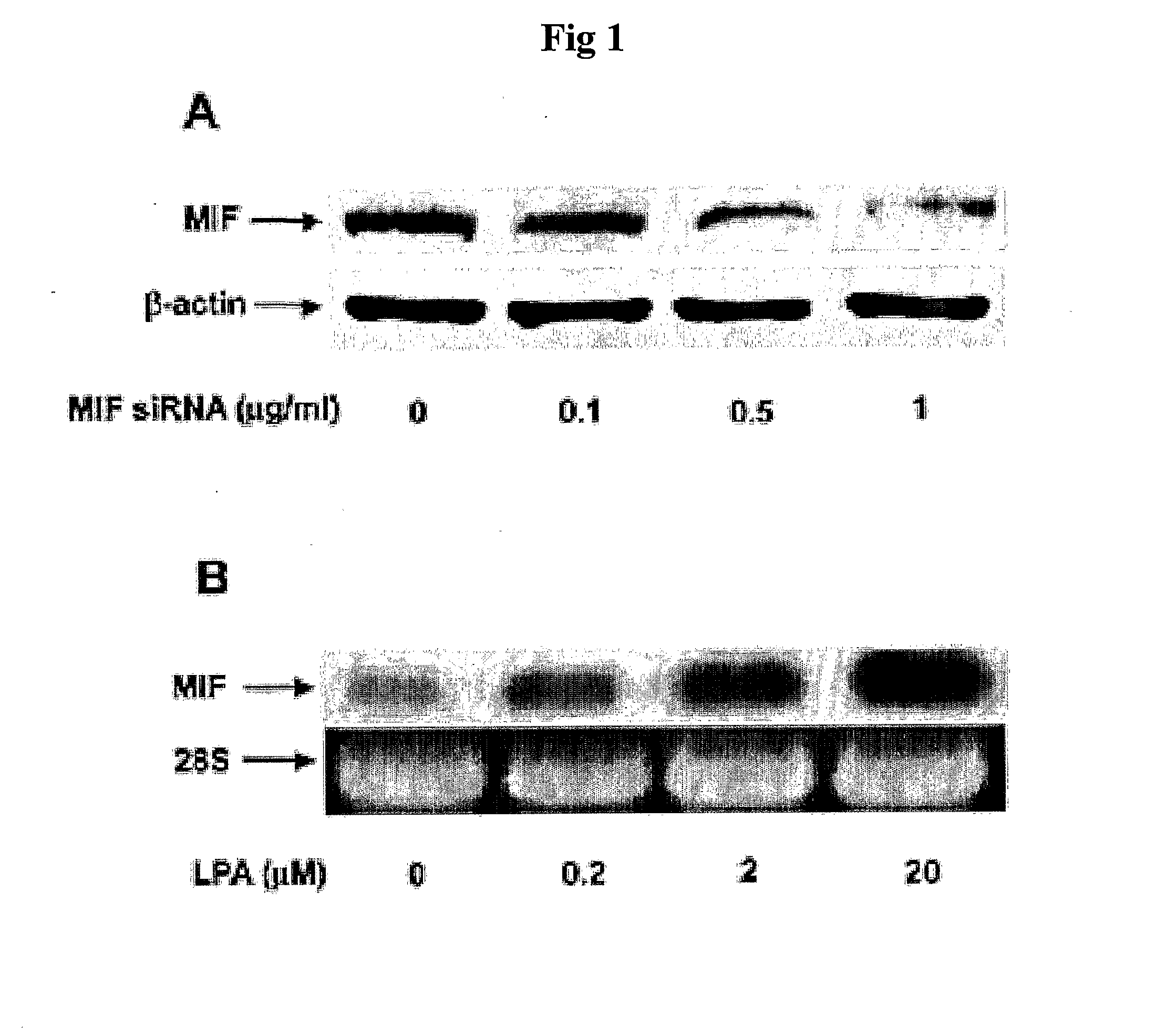 Pharmaceutical Agents for Preventing Metastasis of Cancer