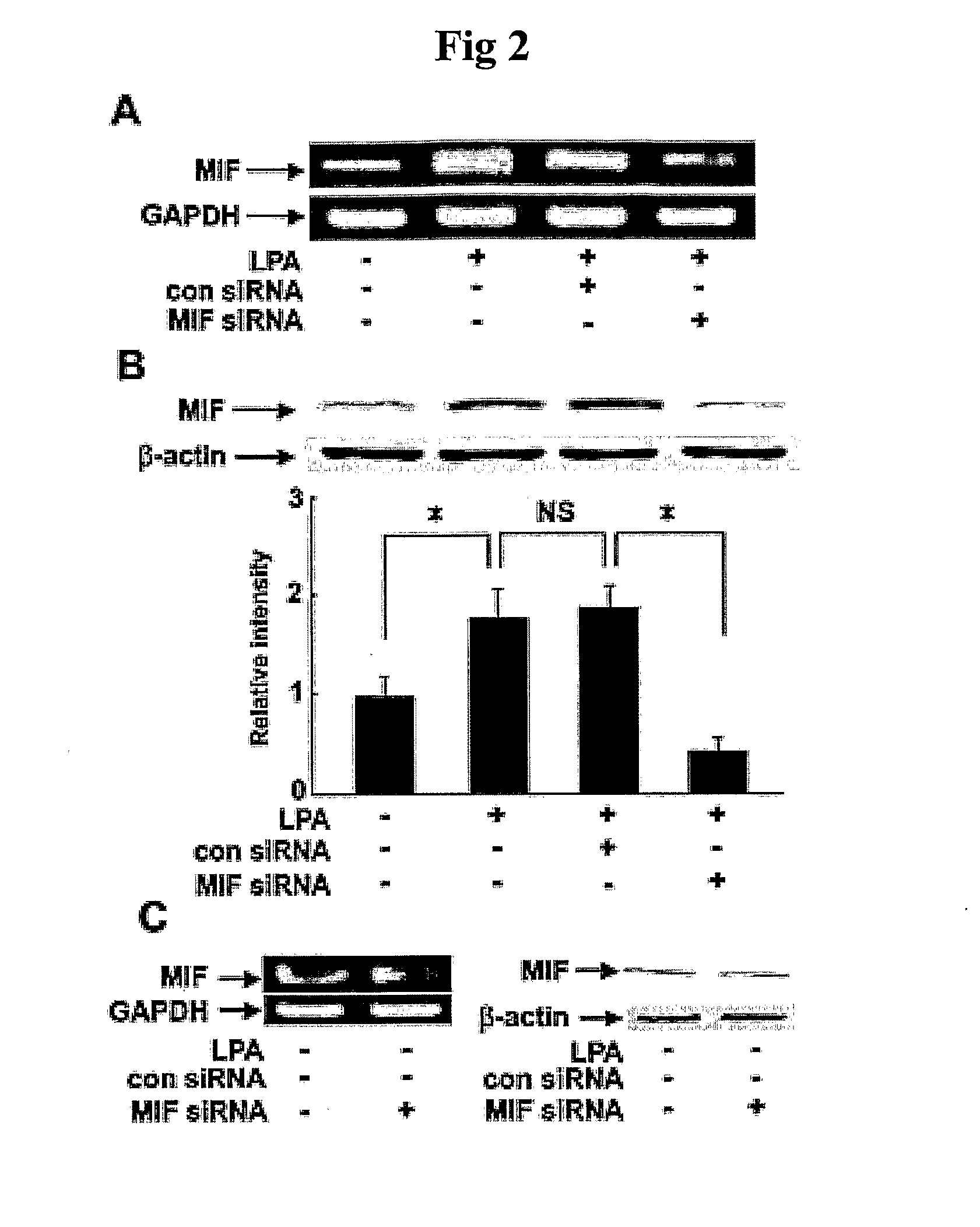 Pharmaceutical Agents for Preventing Metastasis of Cancer