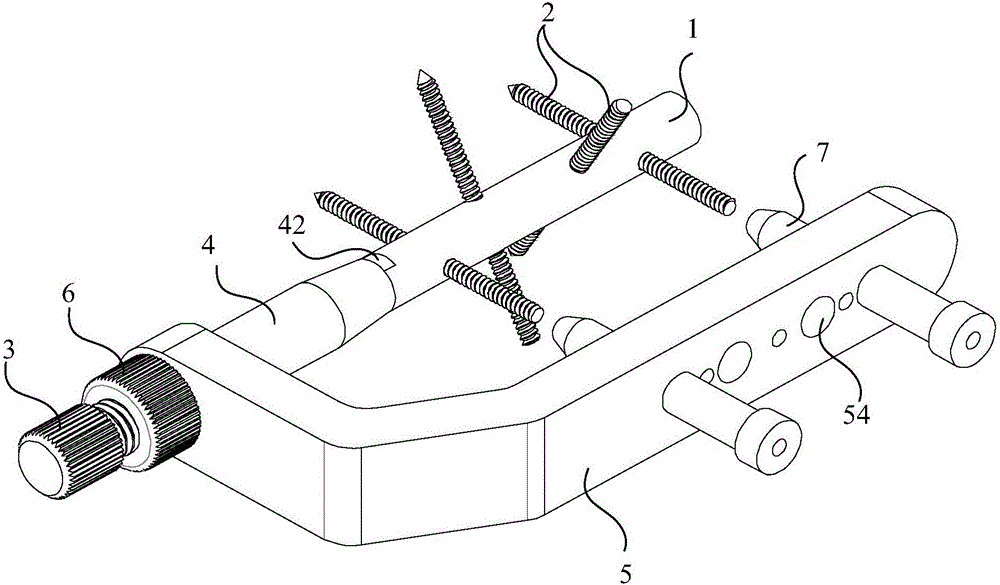 Calcaneal intramedullary fixation system and auxiliary placement instruments