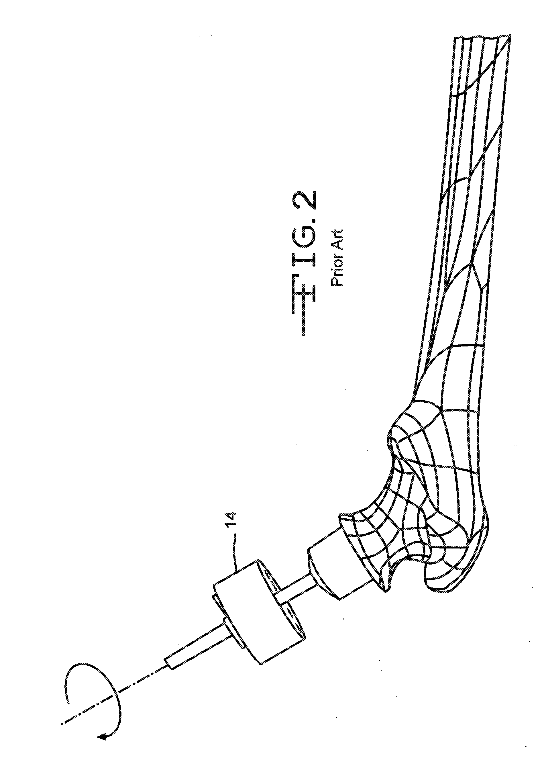 Instrument for reshaping the head of a femur