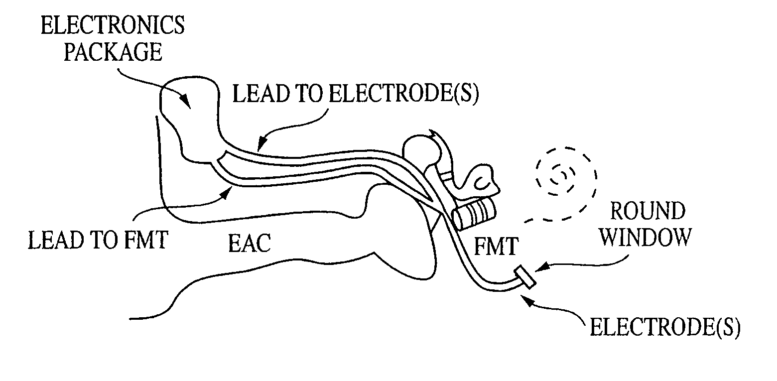 Implantable medical devices with multiple transducers