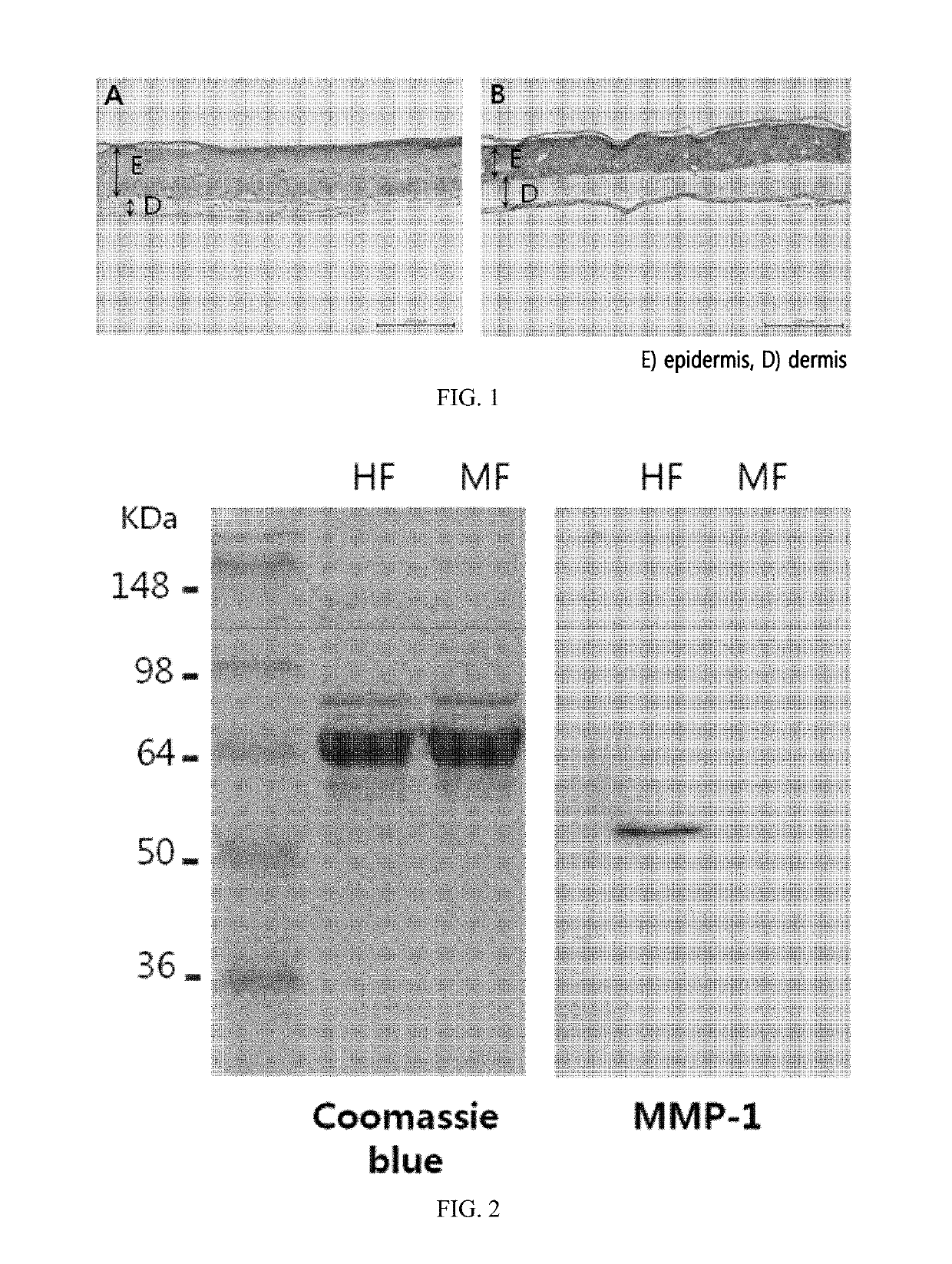 Method for preparing a three-dimensionally cultured skin comprising dermis and epidermis, and the cultured skin made therefrom