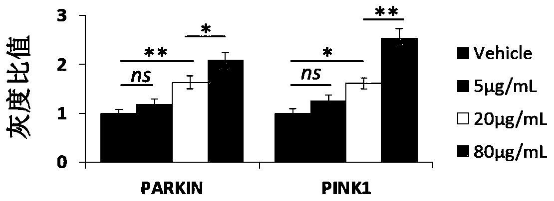 Application of mesenchymal stem cell exosome in preparation of preparations for promoting mitophagy