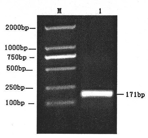 Multiplex real-time fluorescence PCR (polymerase chain reaction) detection primer and method for porcine rabies virus, porcine parvovirus and porcine circovirus type 2