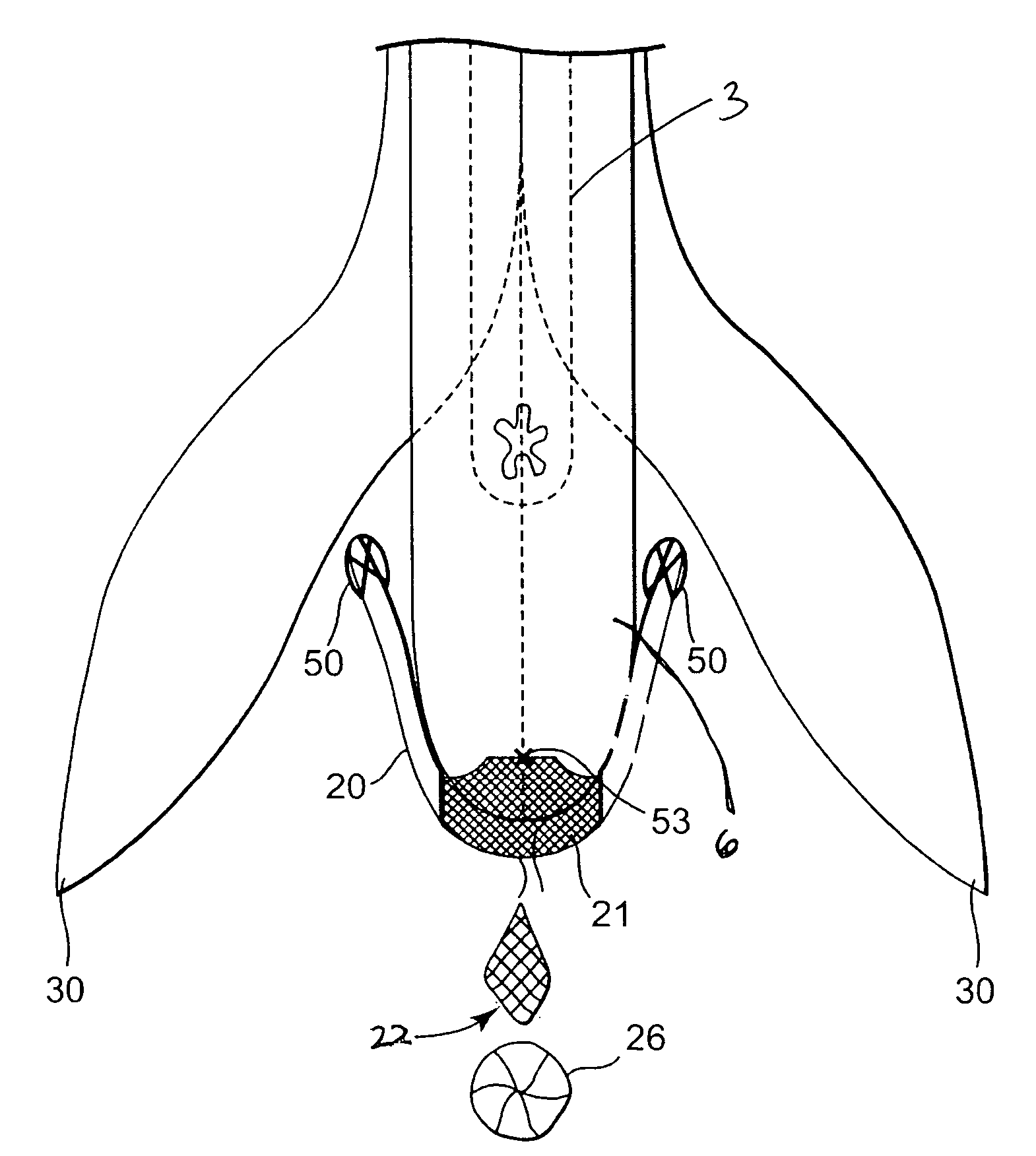 Transobturator methods for installing sling to treat incontinence, and related devices