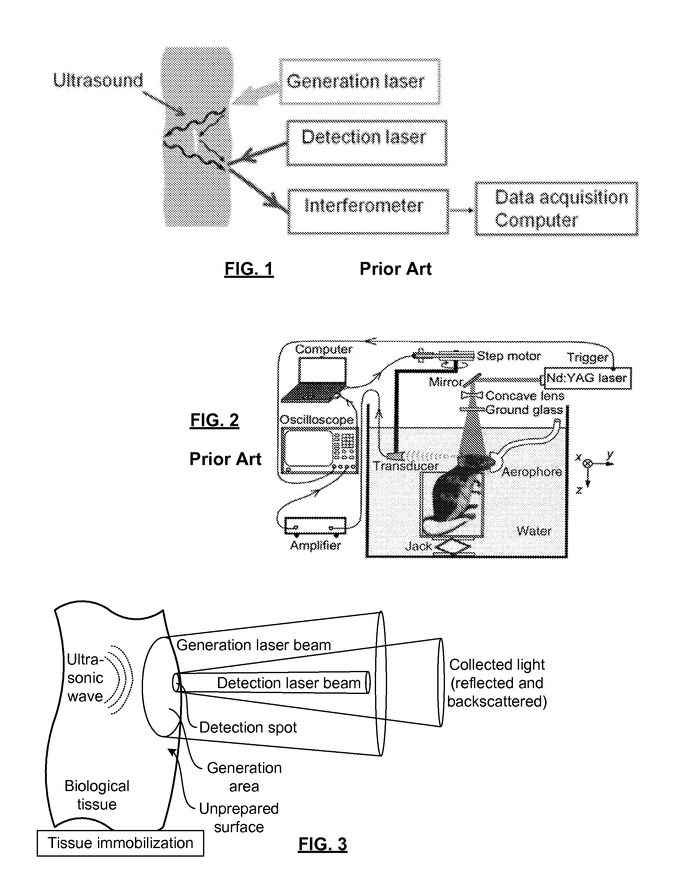 Biological tissue inspection method and system