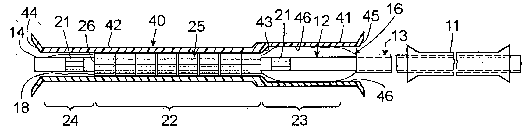 Asymmetric stent delivery system with proximal edge protection and method of manufacture thereof