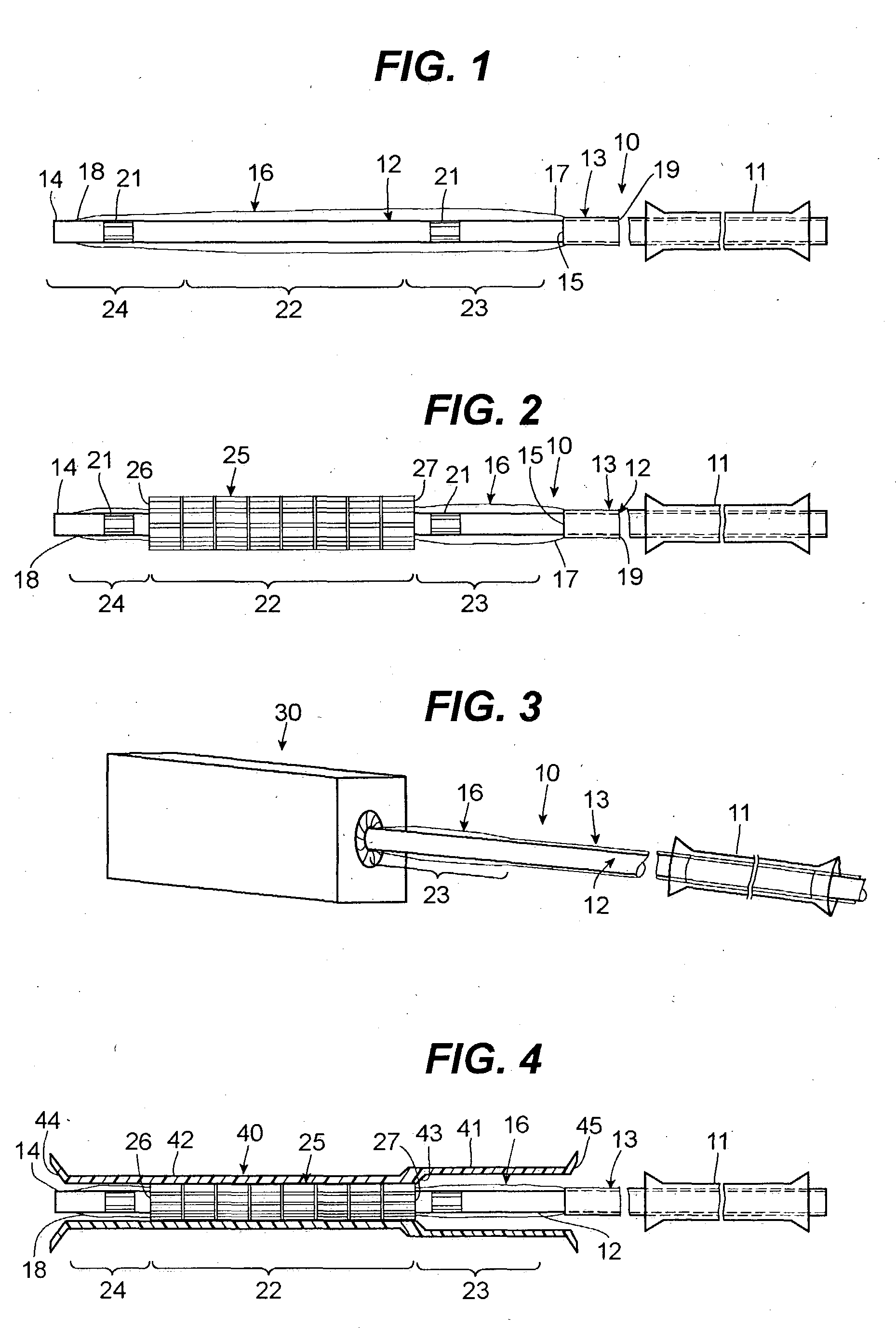 Asymmetric stent delivery system with proximal edge protection and method of manufacture thereof