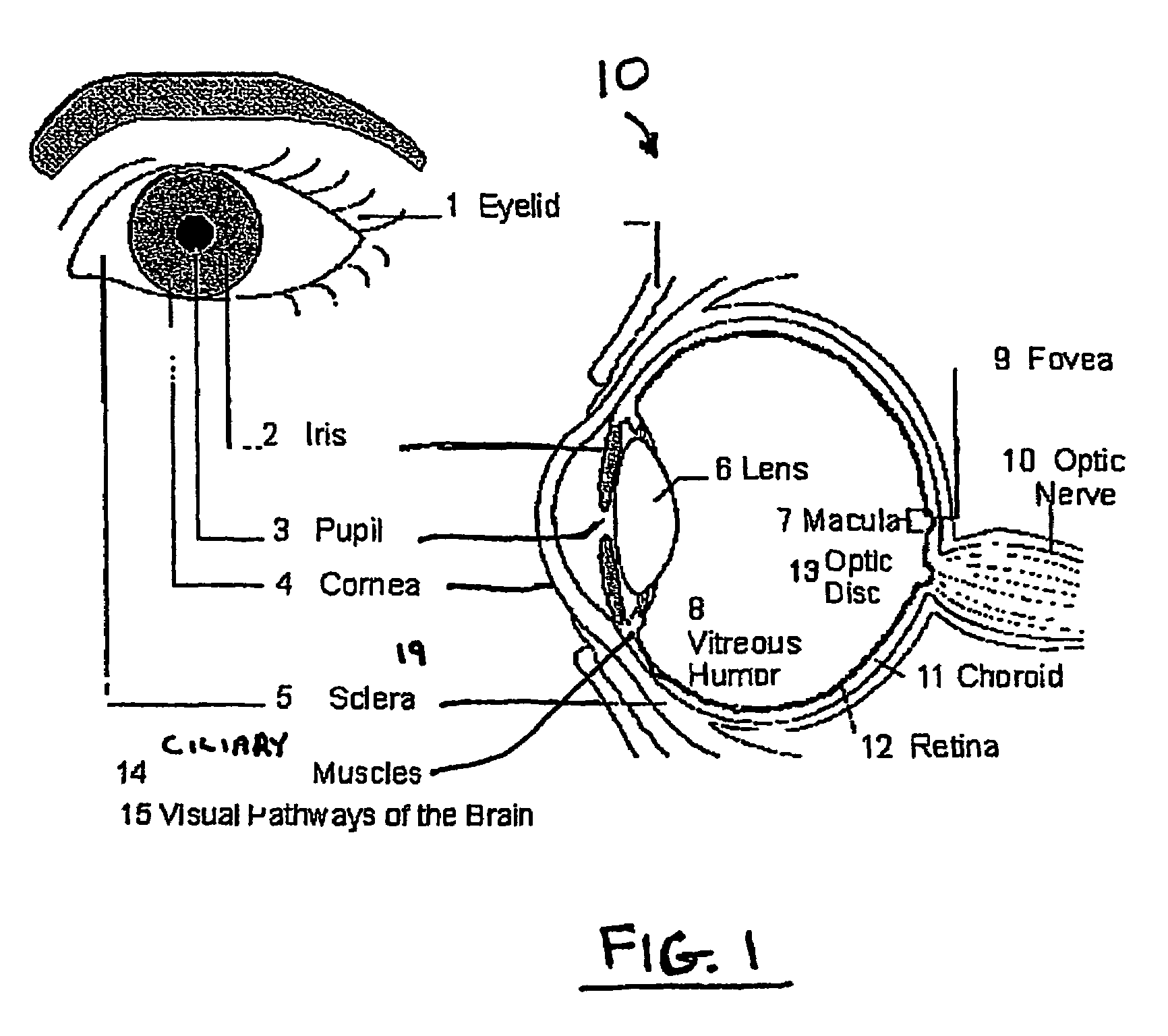 Method and apparatus for enhanced corneal accommodation