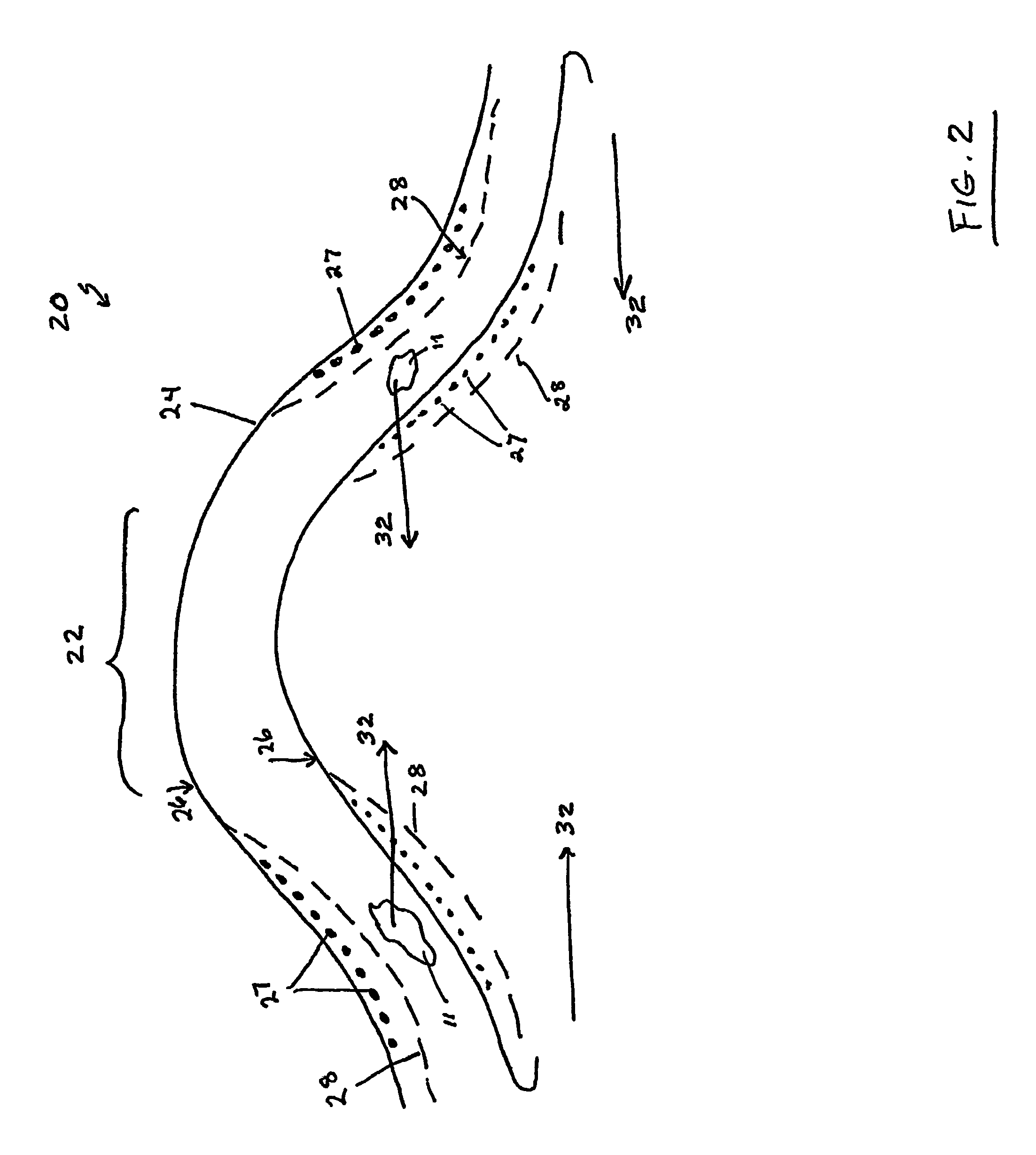 Method and apparatus for enhanced corneal accommodation