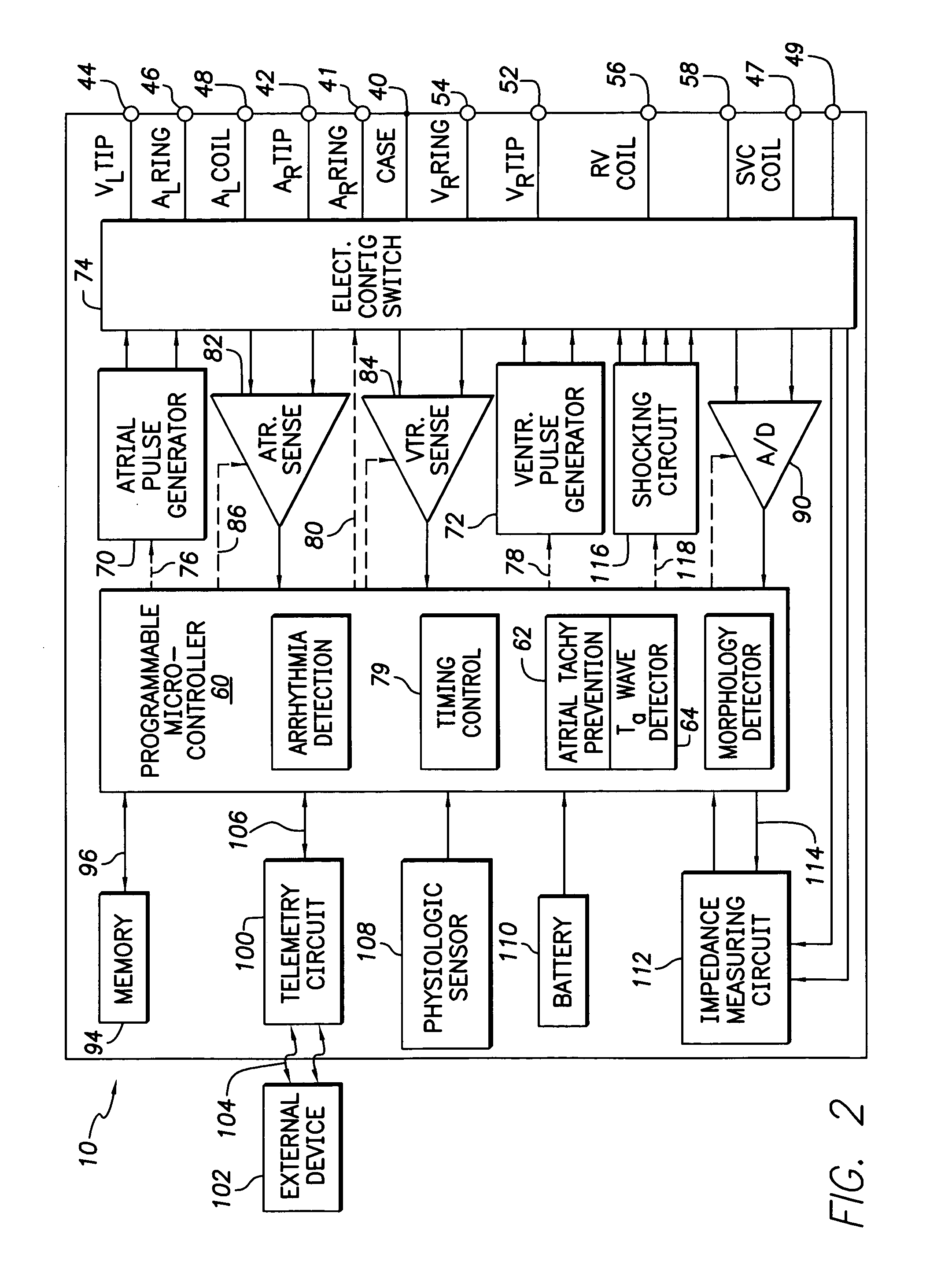 Implantable cardiac stimulation device, system and method that identifies and prevents impending arrhythmias of the atria