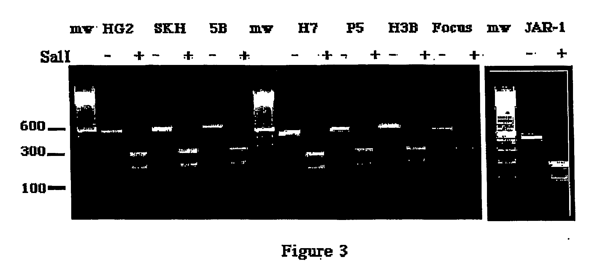 Compositions and methods of treating and diagnosing hepatoma