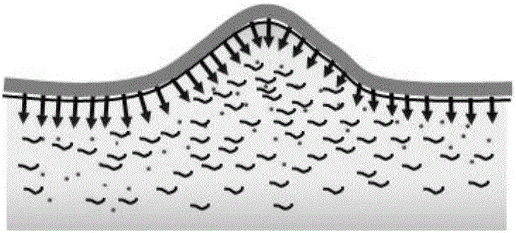 Microneedle for hypertrophic scars and preparation method for microneedle