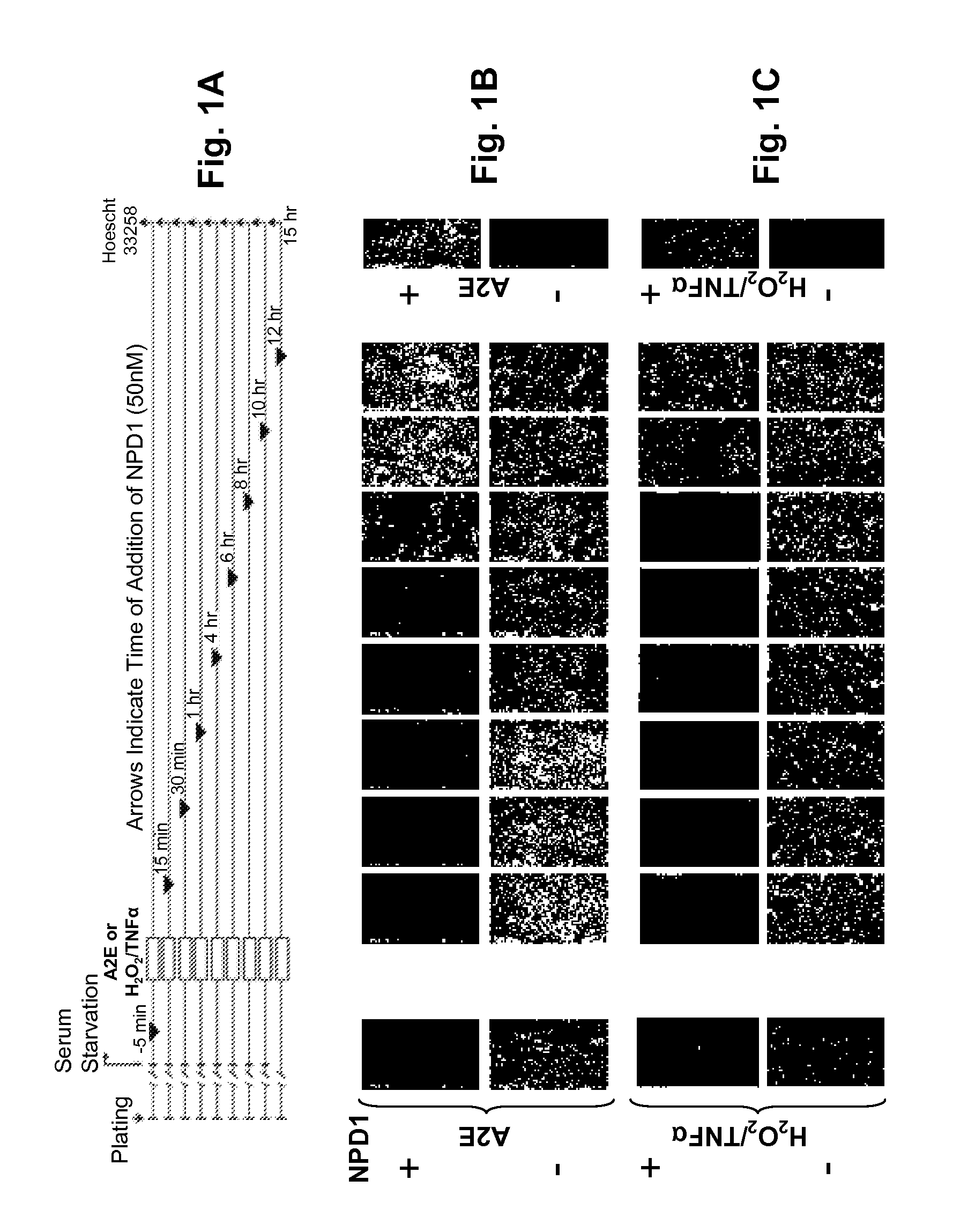 DHA and PEDF, a Therapeutic Composition for Nerve and Retinal Pigment Epithelial Cells