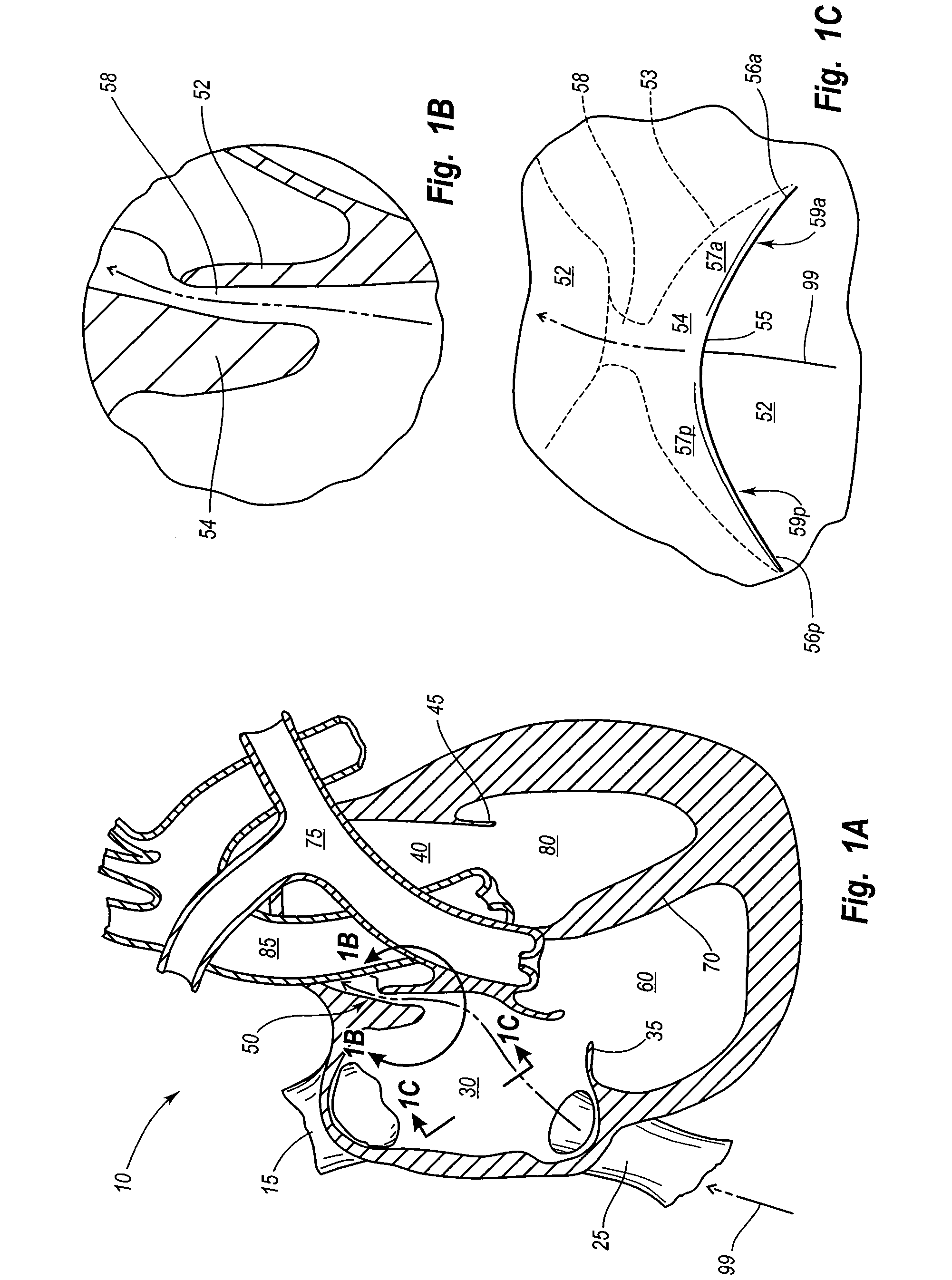 Delivery system for patent foramen ovale closure device