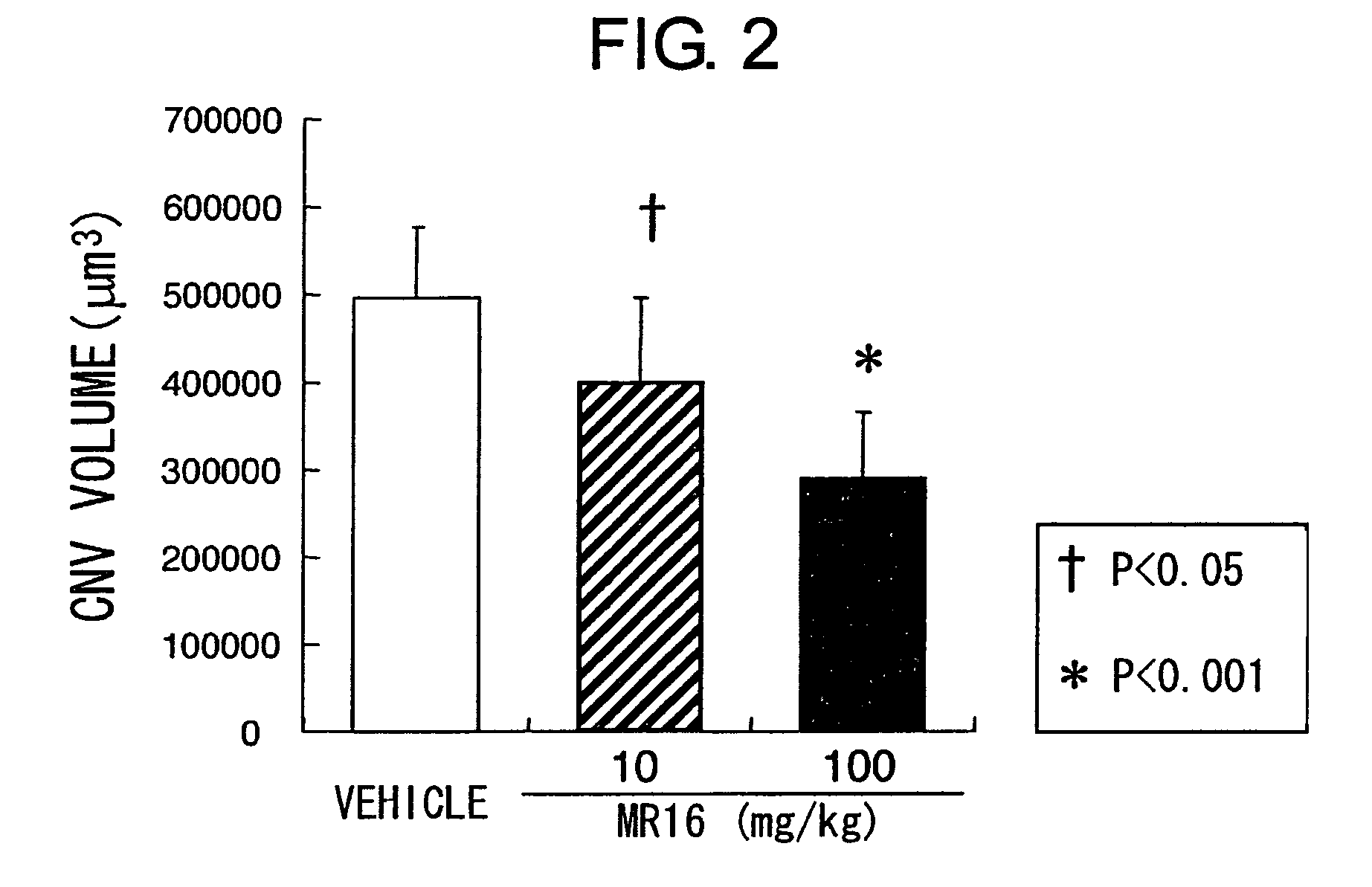 Methods for treating a disease involving choroidal neovascularization by administering an IL-6 receptor antibody