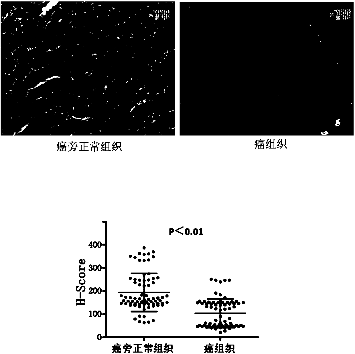 Application of quantitative detection of USP10 protein in prognosis kit of primary liver cancer