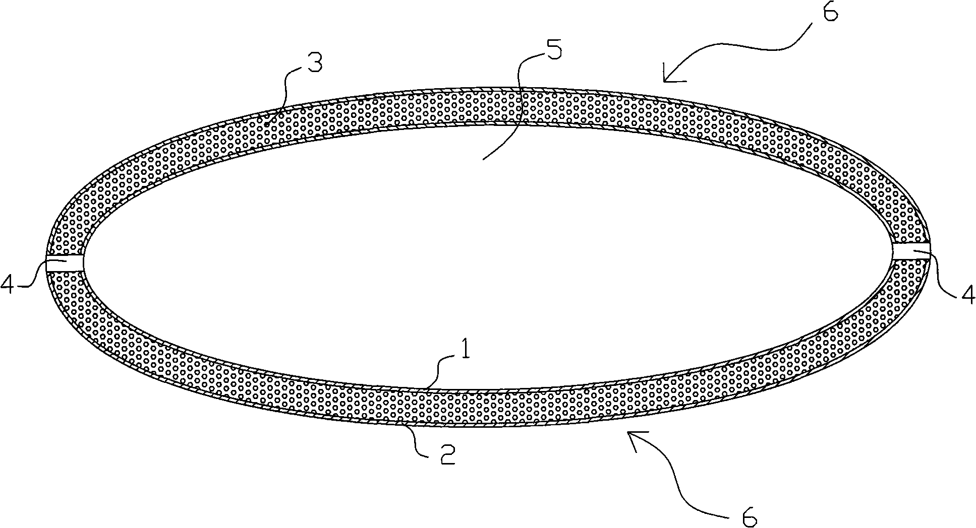 Novel bone surgery fixing system and method of use thereof and polyurethane applied therein